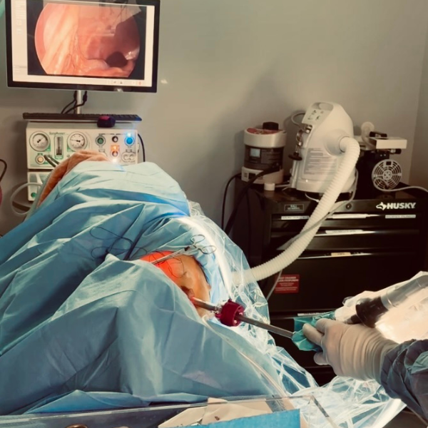 A surgical team performs a laparoscopic procedure, with a monitor displaying internal anatomy and instruments being used on the patient.